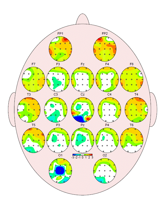 Mapa cerebral QEEG con múltiples topografías por regiones del cuero cabelludo, en tonos verde, amarillo, naranja y azul.