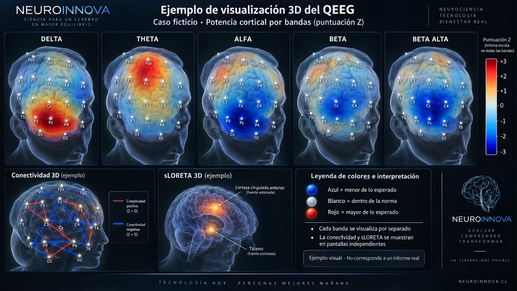 Panel 3D de Neuroinnova muestra mapas QEEG cerebrales por bandas delta, theta, alfa, beta y beta alta, con escala Z.